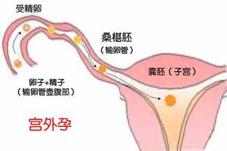 如果不想去公立医院做赠卵试管婴儿，可以选择私立医院吗？