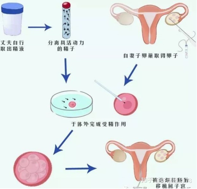 借卵试管婴儿那家好现在选择美中宜和-梅州宜和宜美