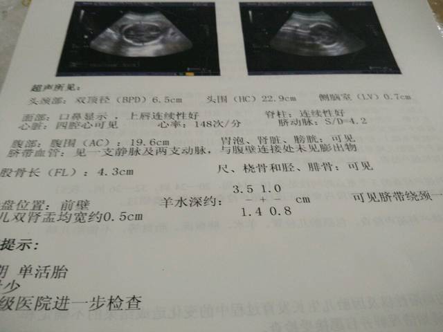 广州省人民医院供卵做试管婴儿