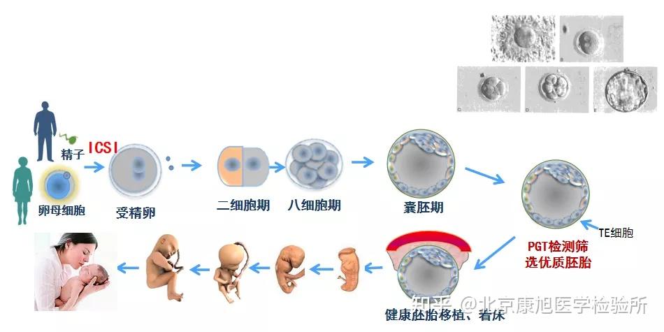 试管双胞胎性别一样吗