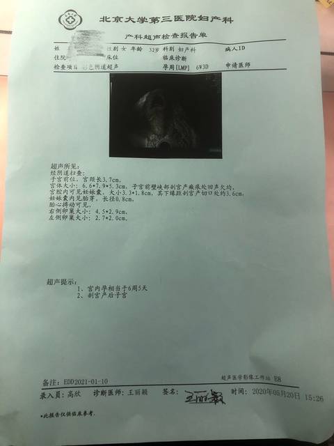 50岁2023借卵代生的几率有多大？看完高龄试管“活产率”数据保准信心大减