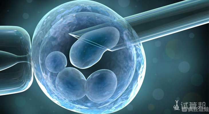 三甲医院可以查男性精子xy的比例吗？