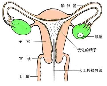 广州代怀做男孩多少钱大约多少钱(公司价格65641元)
