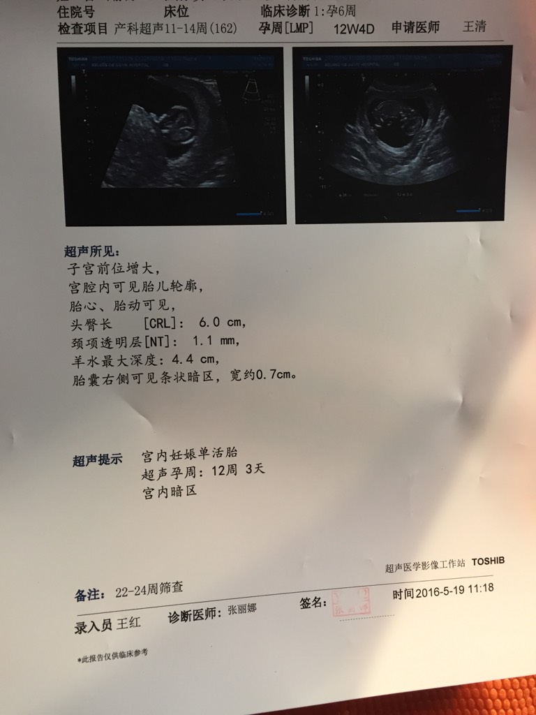 取卵后第三天右边有点疼痛+取卵第三天小肚子右侧疼